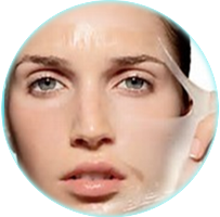 Chemical Peel