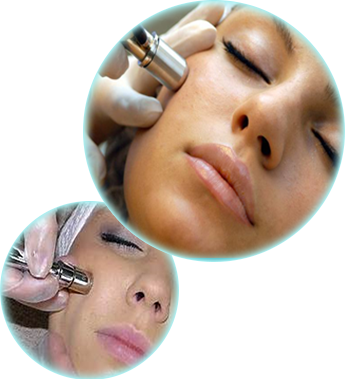 Microdermabrasion Treatment in Sun City West, AZ