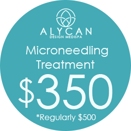 Microneedling Treatment $350, Regularly $500