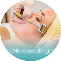 Microneedling